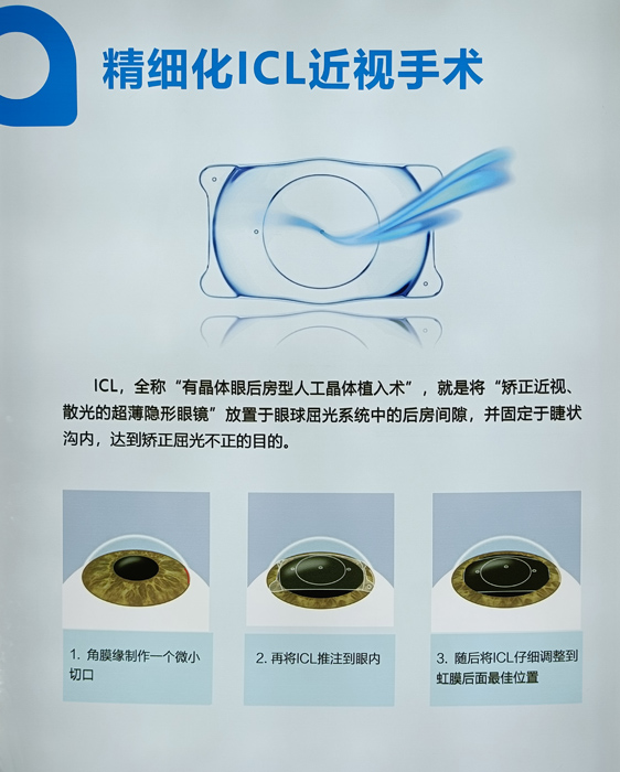寒假摘鏡總動(dòng)員，近視朋友的三種矯正近視方式