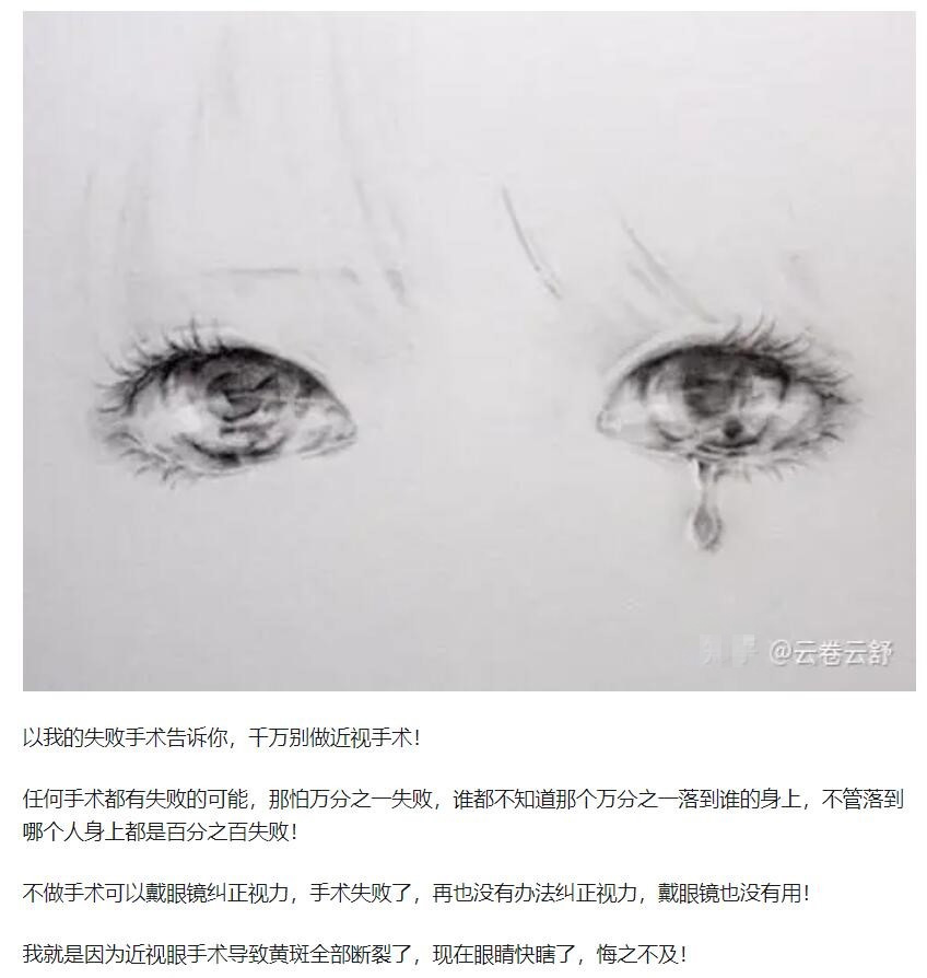 教你，怎樣去了解近視手術(shù)  